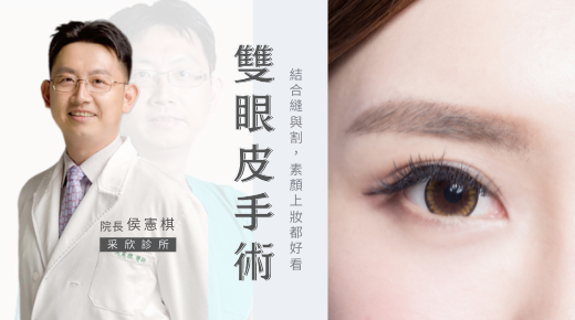 雙眼皮手術