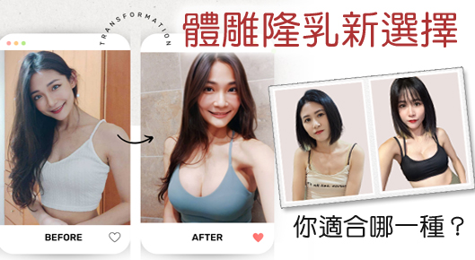 2024隆乳植體的新選擇